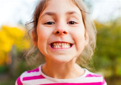 How to Identify If a Permanent Tooth is Emerging