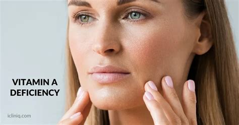 Vitamin A Deficiency - Causes | Benefits | Treatment | and Prevention
