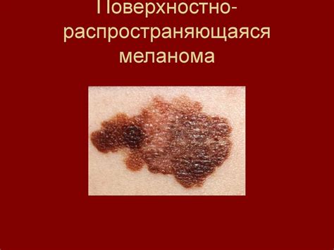 Болезни кожи - презентация онлайн