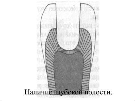Лечебные и изолирующие прокладки - презентация онлайн