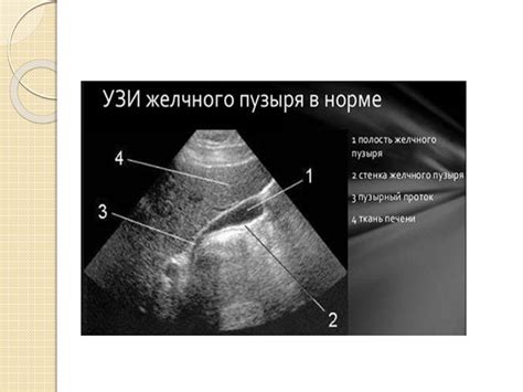 Іш қуысы ағзаларын ультрадыбыстық зерттеу - презентация онлайн