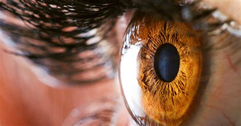 lateral tarsal strip surgery  workhorse  eyelid malposition