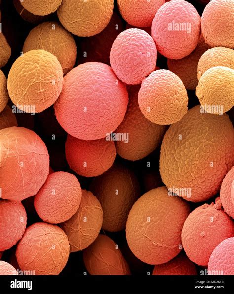 bread mould conidia coloured scanning electron micrograph sem