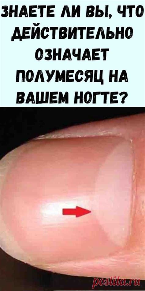 Знаете ли вы, что действительно означает полумесяц на вашем ногте? Отв ...