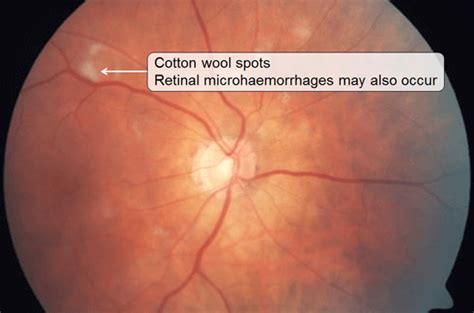 Systemic Disease