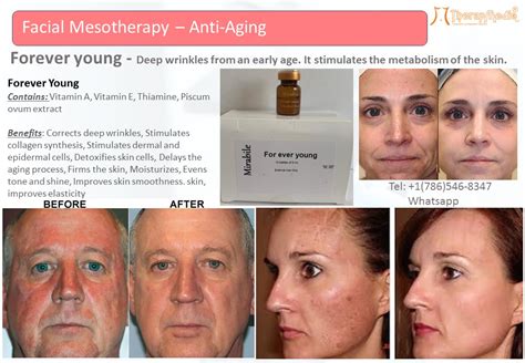 Forever Young - Therap Medic