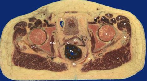 female pelvis  diagram quizlet