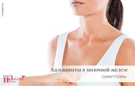 Кальцинаты в молочной железе