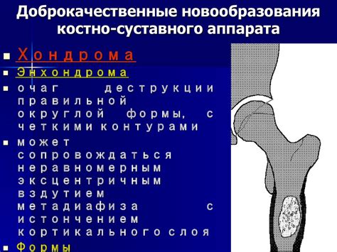 Рентгенодиагностика доброкачественных новообразований костно-суставного ...