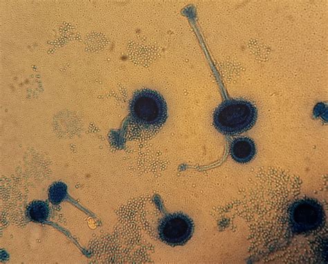 Aspergillus fumigatus Mikroskopie - DocCheck