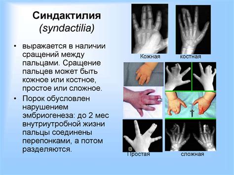 Аномалии и пороки развития - презентация онлайн