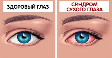 Почему дергается левый глаз? Причины, описание, фото и видео - Научно ...