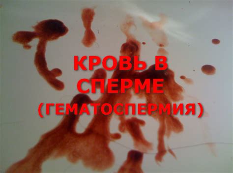 Почему появляется кровь в сперме? - Медицина и здоровье