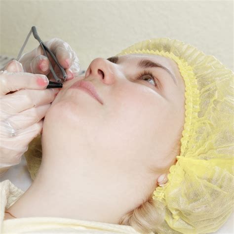 Electrolysis | Durban Cosmetic Laser Centre