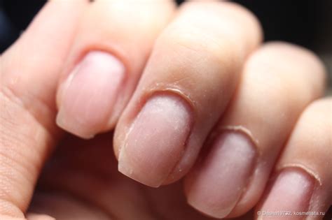 Как быстро это исправить: сломанный ноготь | Отзывы покупателей ...