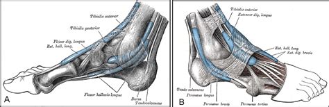 Lateral Subtalar Dislocation in the Trauma Room Setting - The Journal ...