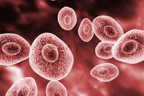 Pneumocystis Infections | Pneumocystis Pneumonia | MedlinePlus