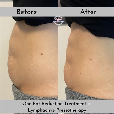 Brandybilly: The Before & After Photos Will SHOCK You Image 5