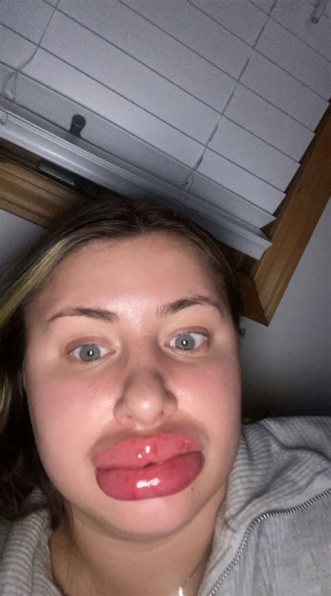 Monsters Inc Lips 8