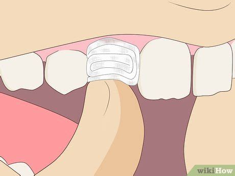 how to remove a tooth at home without pain
