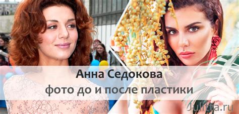 Анна СЕДОКОВА до пластики и после: +15 новых ФОТО певицы