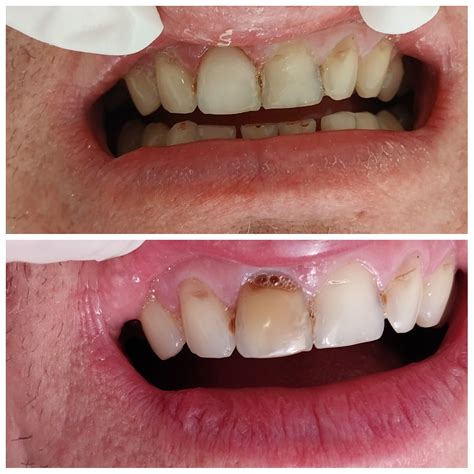 Стоматология Pro Dental г. Полевской – Запись к стоматологу – Зубная ...