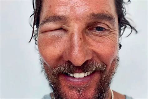 Matthew McConaughey Shocks Fans with Bold Bald Look - Hunter Games Magazine