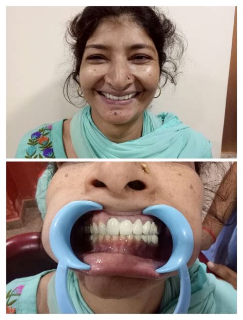 Facio Dental Super Speciality Clinic, Dental Doctors Clinic in Vasant ...