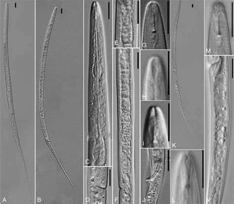 LM pictures of Lelenchus leptosome populations 1 and 2. (K-N) Lelenchus ...