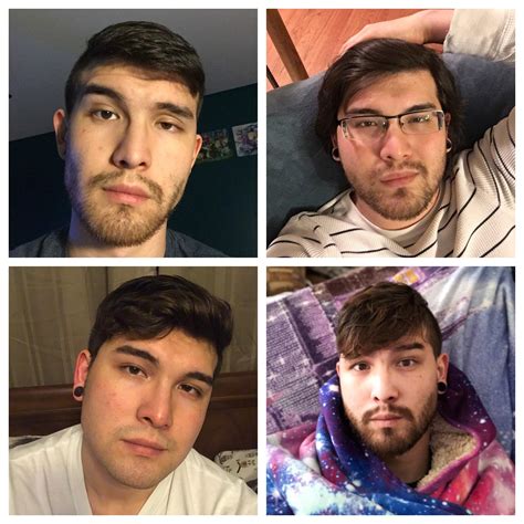 185 best LASIK images on Pholder | Pics, Mildlyinteresting and Uglyduckling