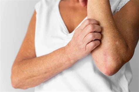 kurap bisa muncul   bagian tubuh berikut  berikut gejala
