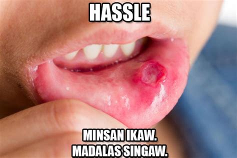 These Memes Perfectly Describe How It Feels to Have Singaw