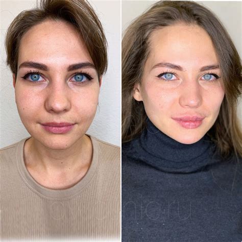 Процедуры инъекции липолитиков от 2490 руб/мл - BeautyWay Clinic 8 (499 ...