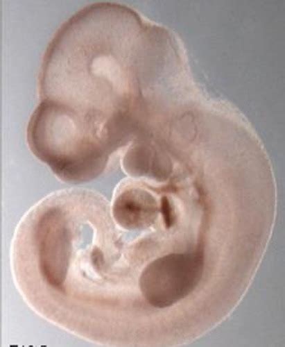 Module 3 - Lecture 3: Morphogenesis Flashcards | Quizlet