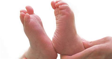 Children’s Foot Problems - Burbank Podiatrist | Los Angeles Foot ...