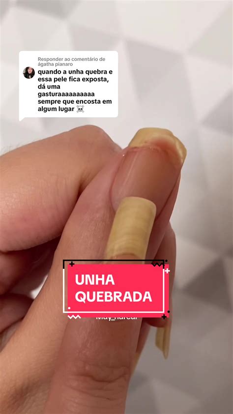 Unha Quebrada Na Carne O Que Fazer - Como recuperar unhas quebradas: minha experiência | TikTok