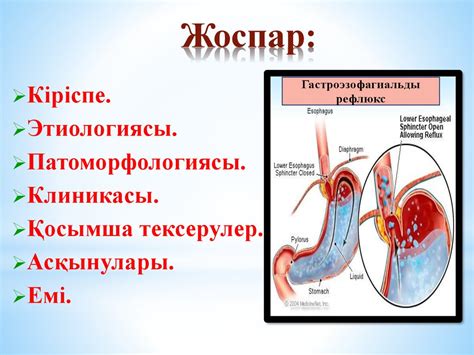 Гастроэзофагиальді рефлюкс - презентация онлайн