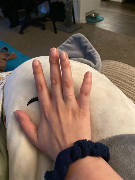 Why is my pinky like this? : r/isthisnormal