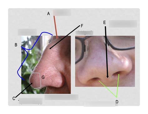 diagram   nose diagram quizlet