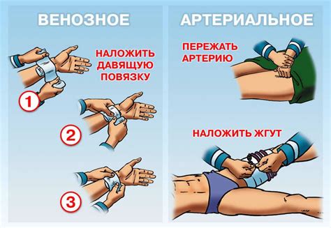 Оказание первой помощи пострадавшим на производстве