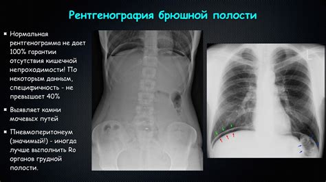 Острый живот и травматические повреждения брюшной полости. Современные...