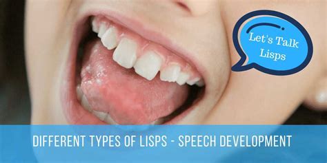 What is a lisp? | SpeechNet Speech Pathology