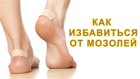 КАК БЫСТРО ИЗБАВИТЬСЯ ОТ МОЗОЛЕЙ НА НОГАХ - YouTube
