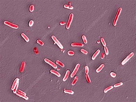 Pseudomonas Aeruginosa Gram Stain