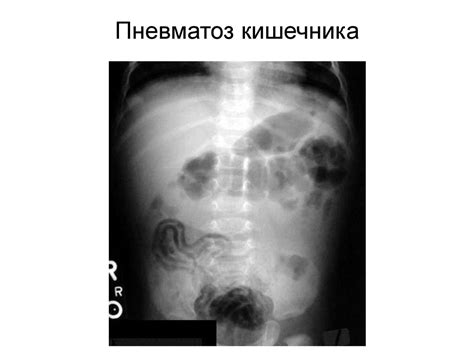 Неотложные хирургические заболевания у детей - презентация онлайн