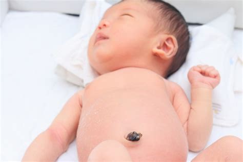 子育て長田こどもクリニック | 赤ちゃんのおへそに出る症状・よくあるトラブルと対処法