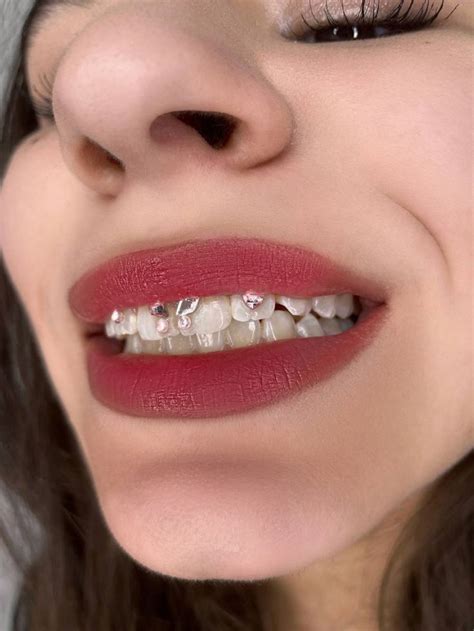 Скайсы на зубы🧞‍♀️ | Instagram profile, Piercing, Instagram
