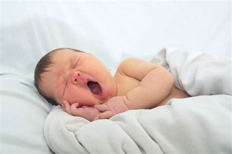 Sandifer syndrome in babies causes symptoms and treatment – Artofit