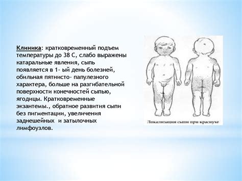 Инфекционные болезни. Корь - презентация онлайн
