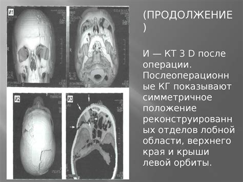 Травмы глаза - презентация онлайн